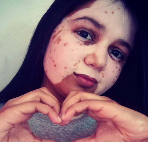 crazy_rio_alvina_motilall_blog_article_womens_month_19